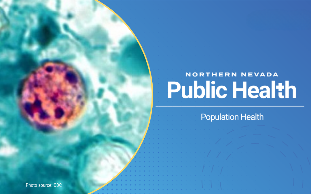 NNPH reports first cyclosporiasis case in Washoe County in 2026